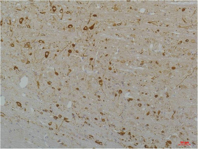 Immunohistochemical analysis of paraffin-embedded Rat Brain Tissue using Cav1. 3Rabbit pAb diluted at 1:200.